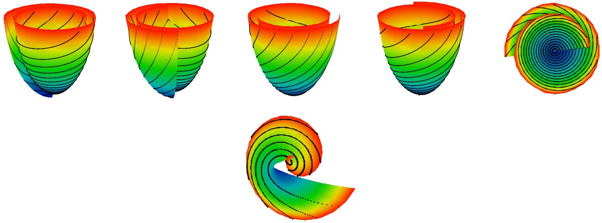 Figure 11