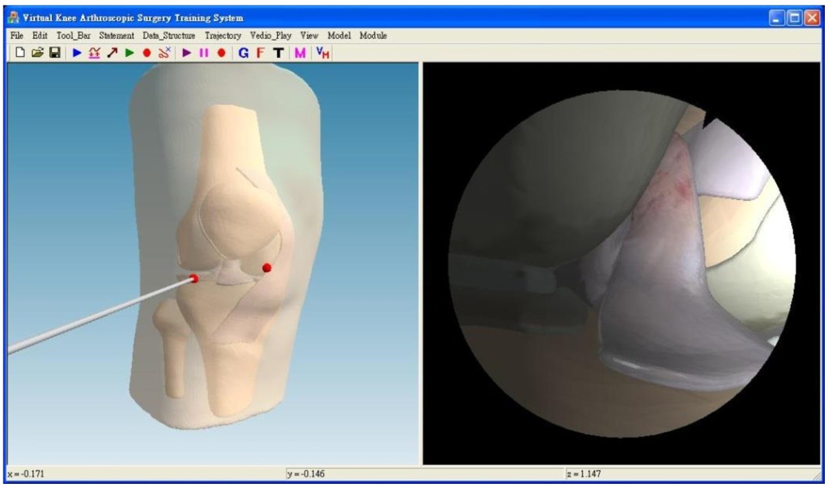 Figure 13