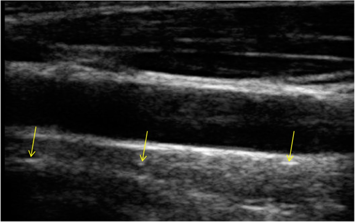 Figure 15