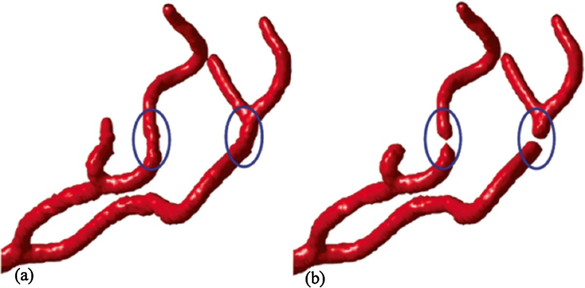 Figure 11