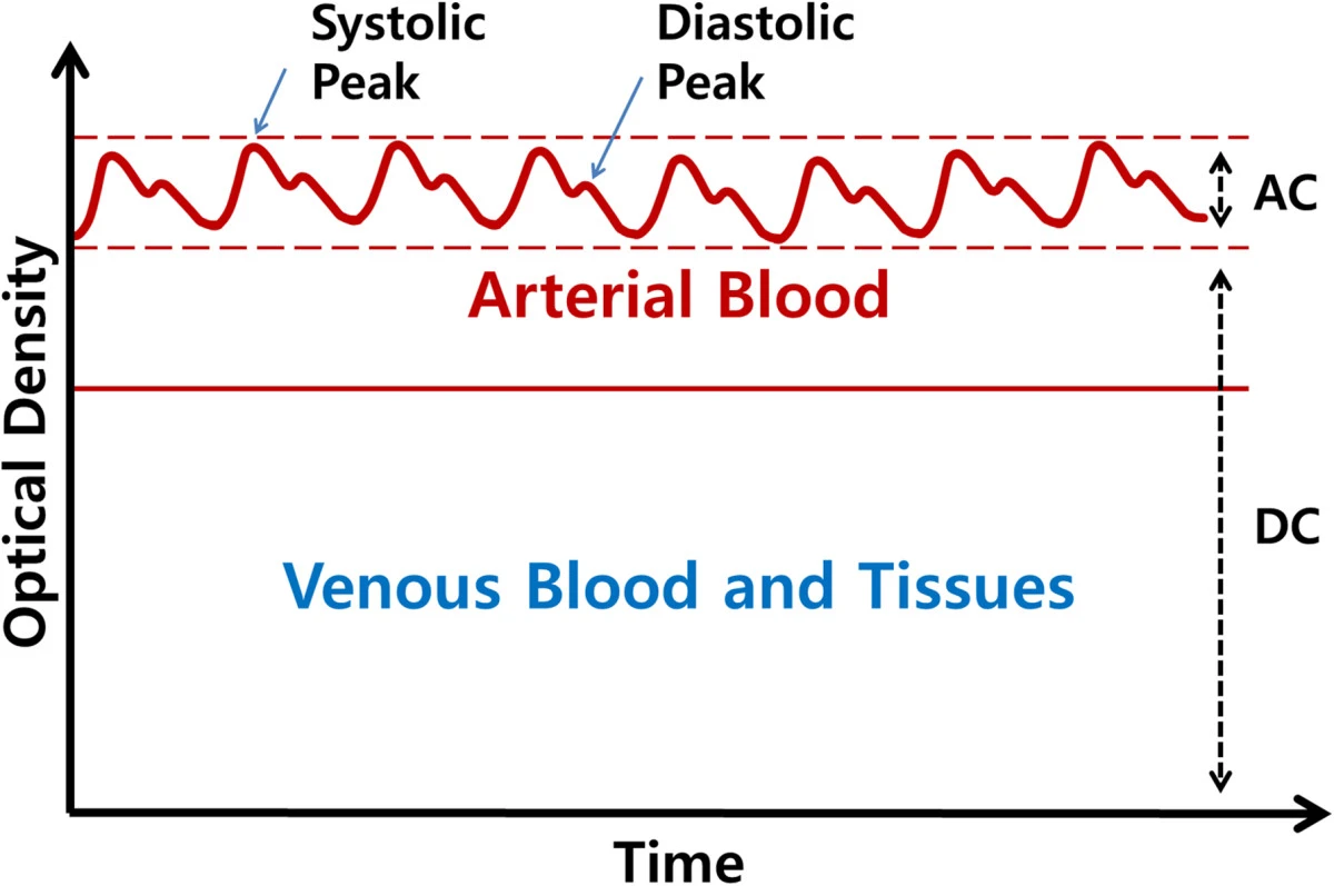 Composition of PPG. PPG wave is generated by fluctuating volume of arterial blood. Figure from Park & Lee<span class='ref'><span class='refnum'></span><span class='refbody'>Real-time estimation of respiratory rate from a photoplethysmogram using an adaptive lattice notch filter- Chanki Park & Boreom Lee - <a href='https://biomedical-engineering-online.biomedcentral.com/articles/10.1186/1475-925X-13-170'>DOI: 10.1186/1475-925X-13-170</a></span></span>