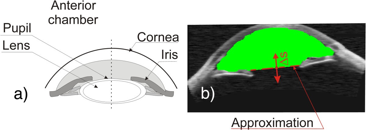 Figure 13