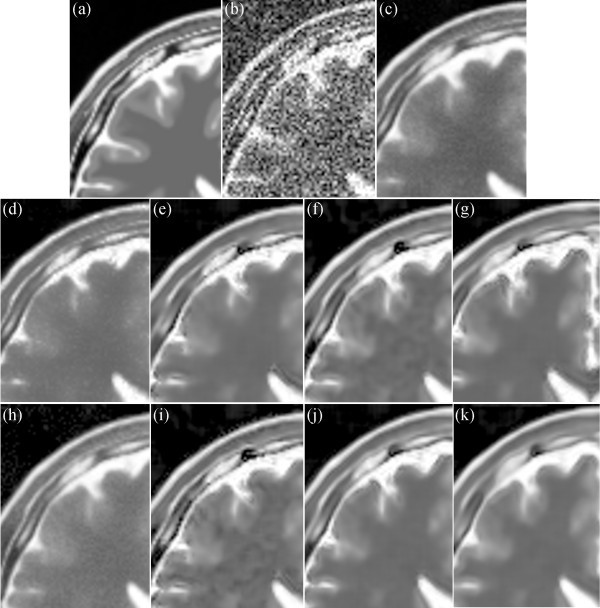 Figure 17