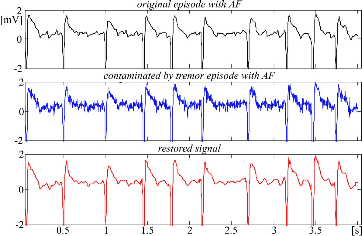 Figure 12