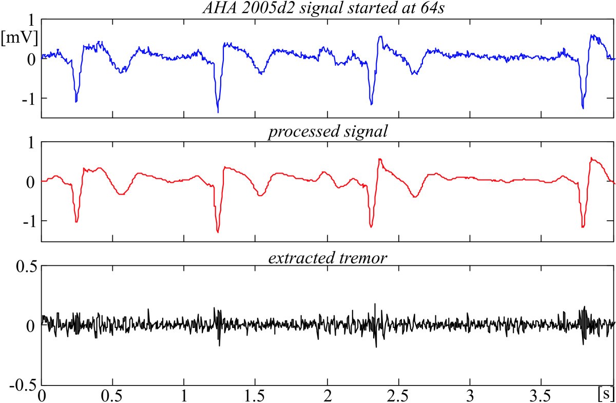 Figure 14