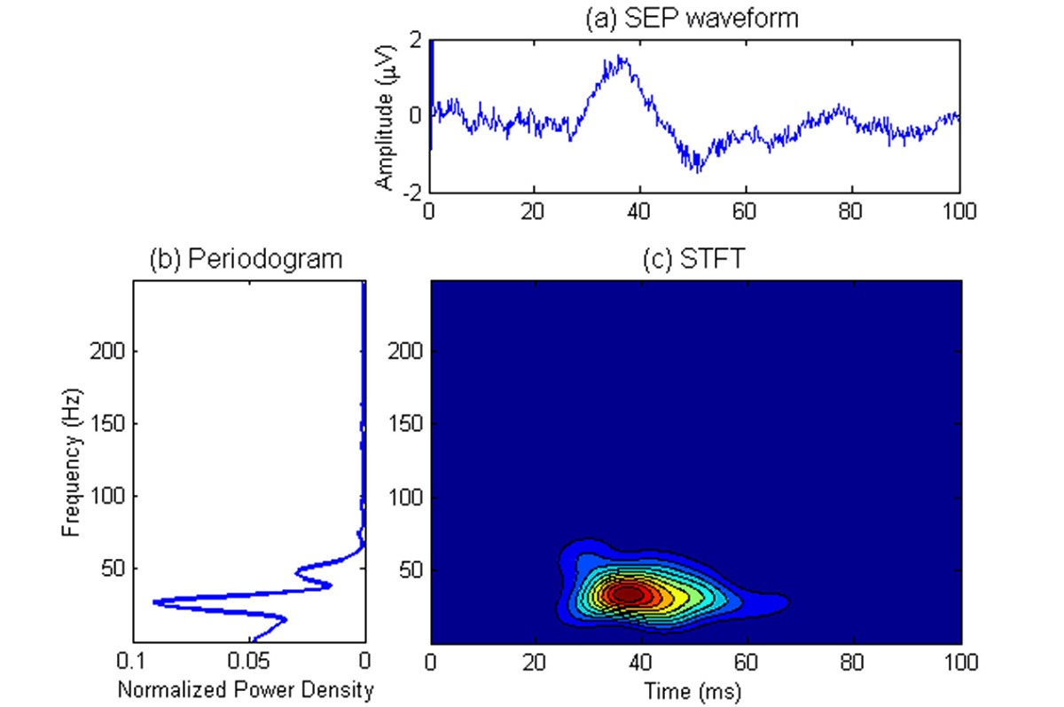 Figure 1