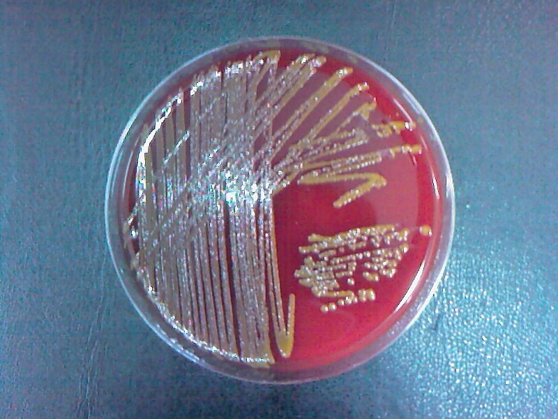 Alcaligenes faecalis биохимические свойства. Alcaligenes faecalis. Alcaligenes на производстве. Enterococcus faecalis на среде. Alcaligenes faecalis.