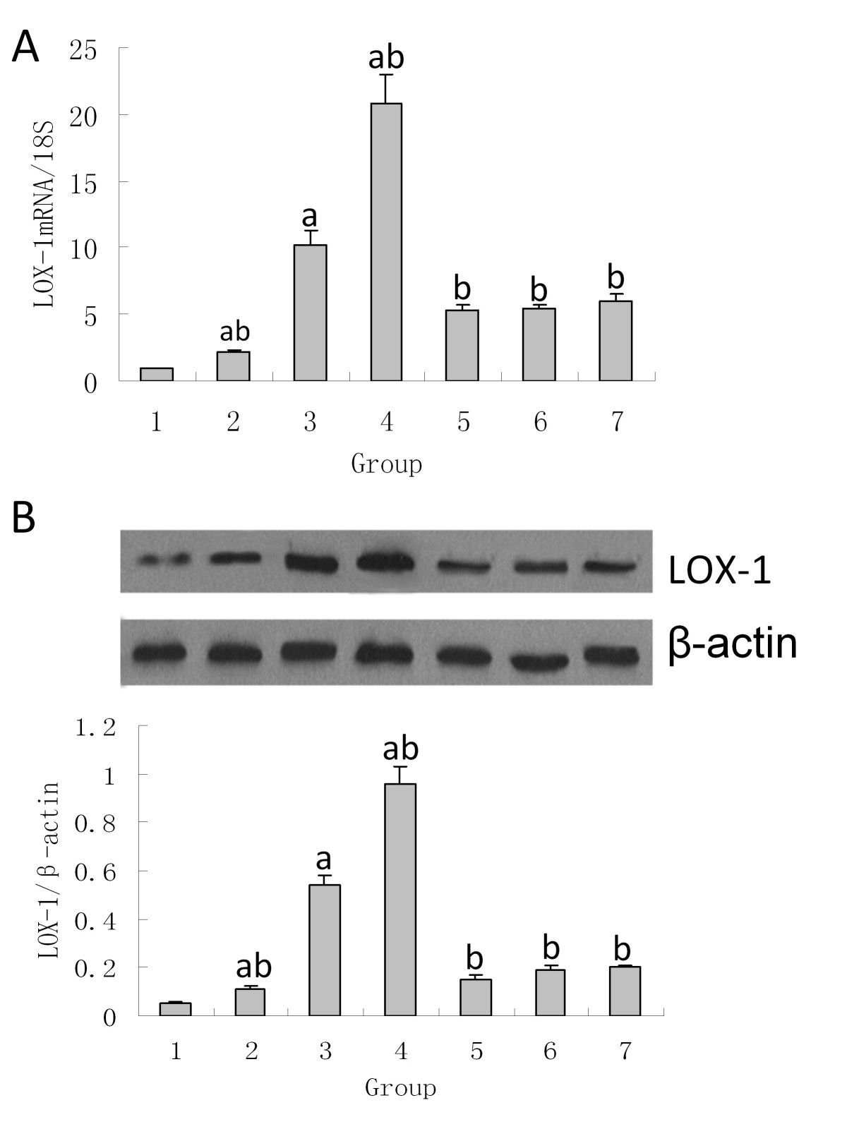 Role Of Lox 1 And Ros In Oxidized Low Density Lipoprotein Induced Epithelial Mesenchymal Transition Of Nrk52e Lipids In Health And Disease Full Text