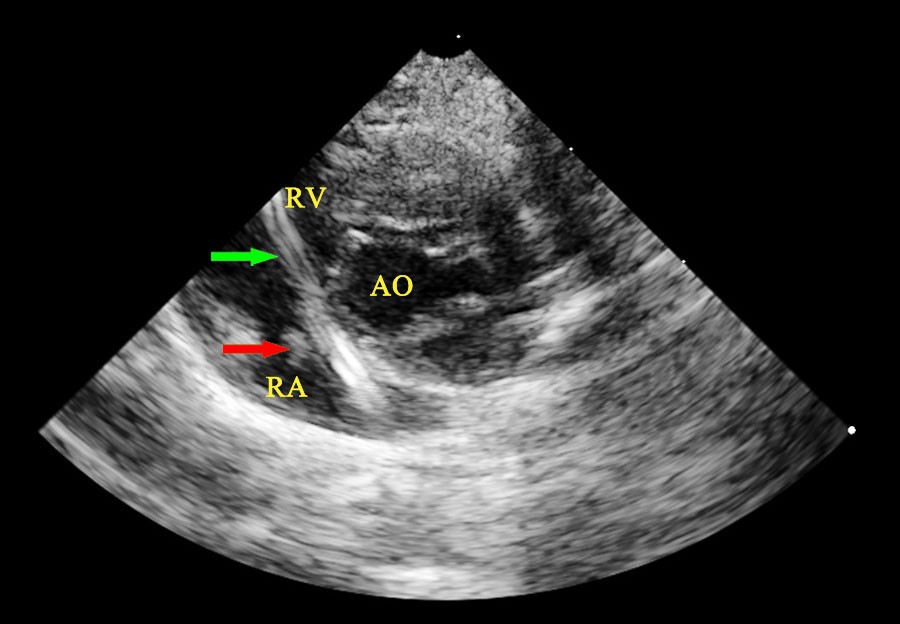 Figure 5