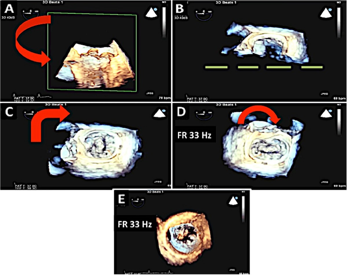 Figure 14