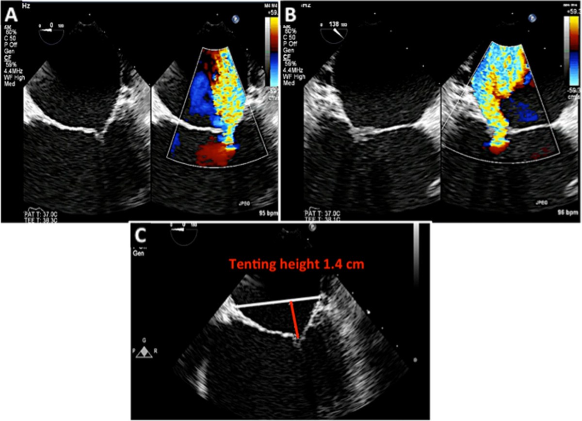 Figure 19