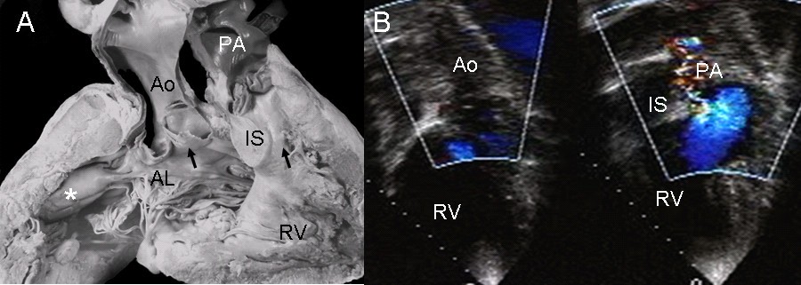 Figure 17