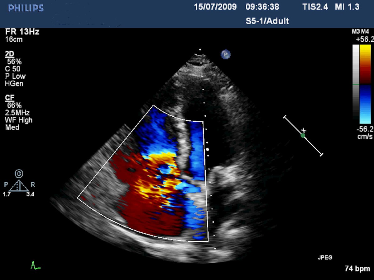 Figure 4