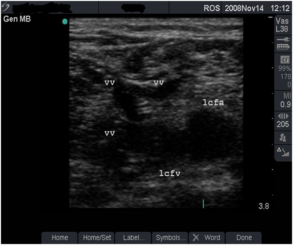 Figure 12