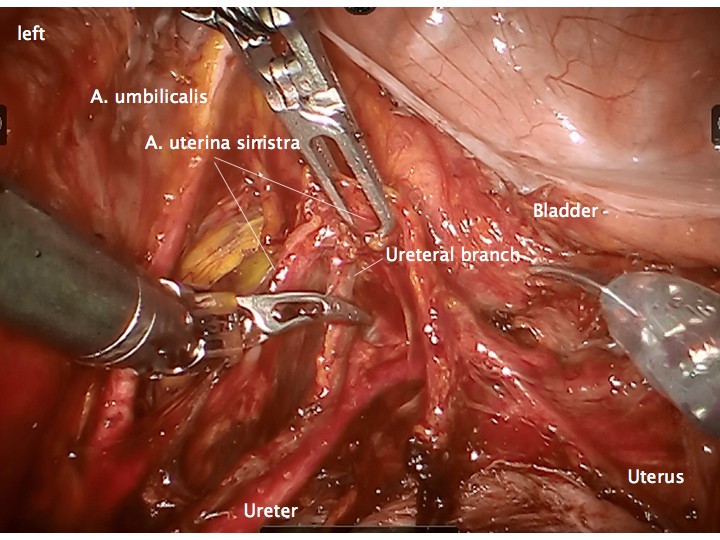 Figure 14