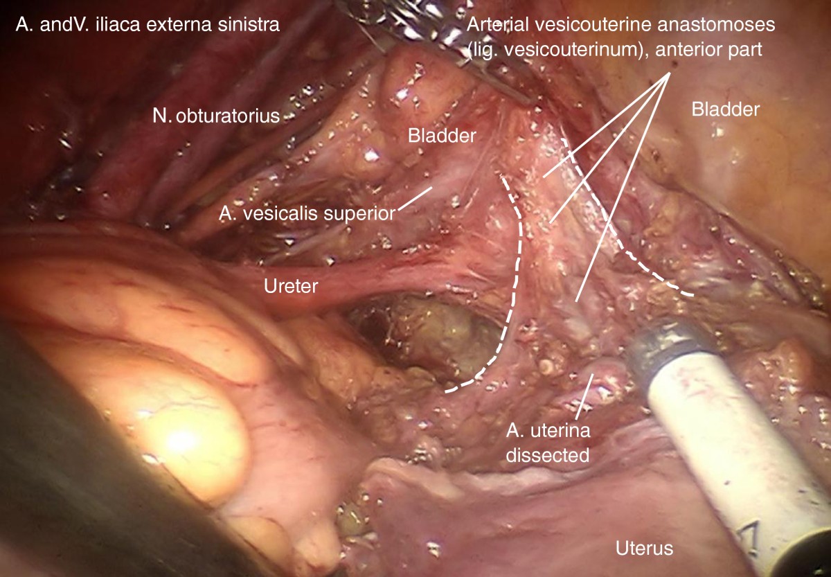 Figure 15