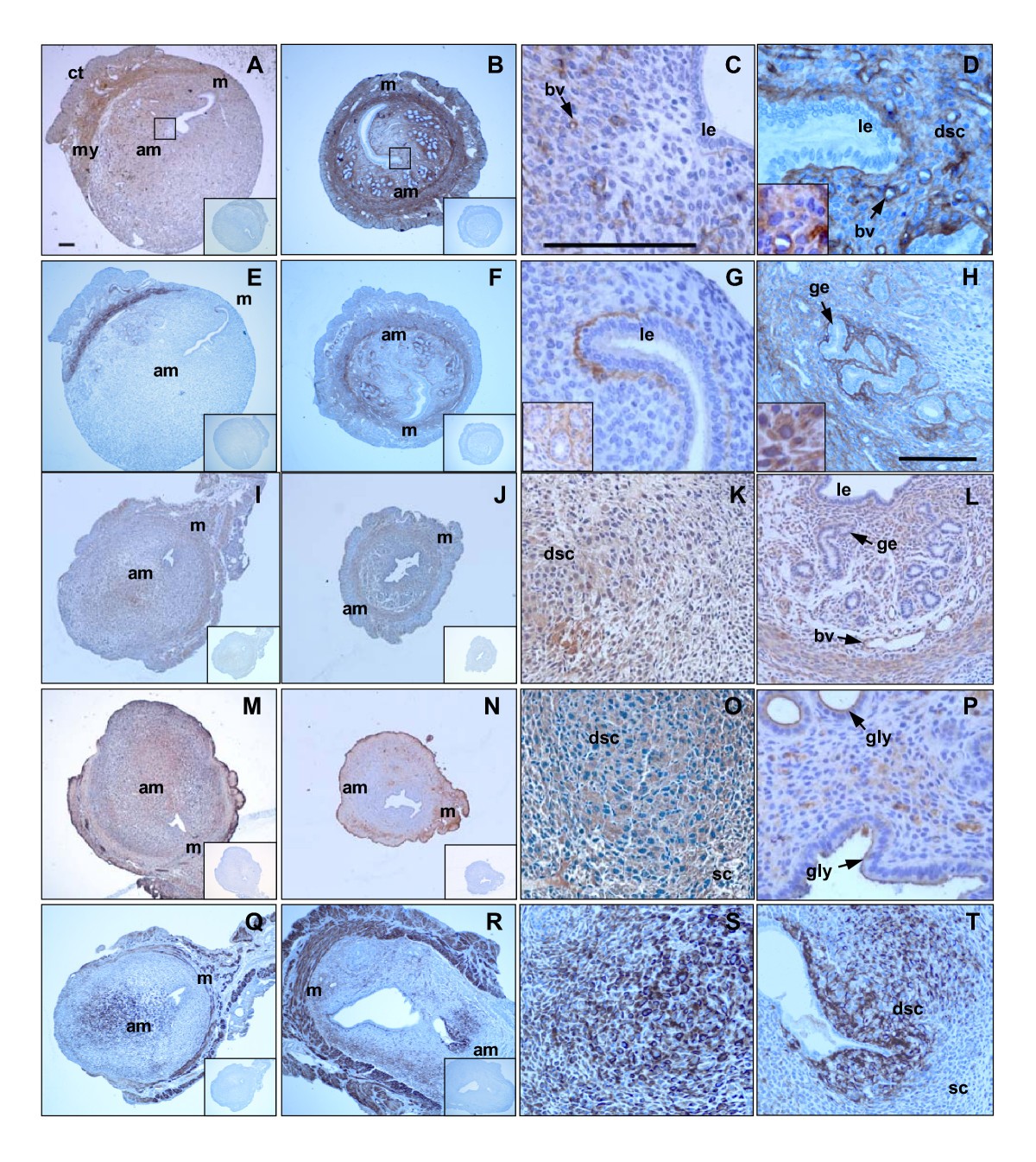 Uterine Extracellular Matrix Components Are Altered During Defective Decidualization In Interleukin 11 Receptor A Deficient Mice Reproductive Biology And Endocrinology Full Text