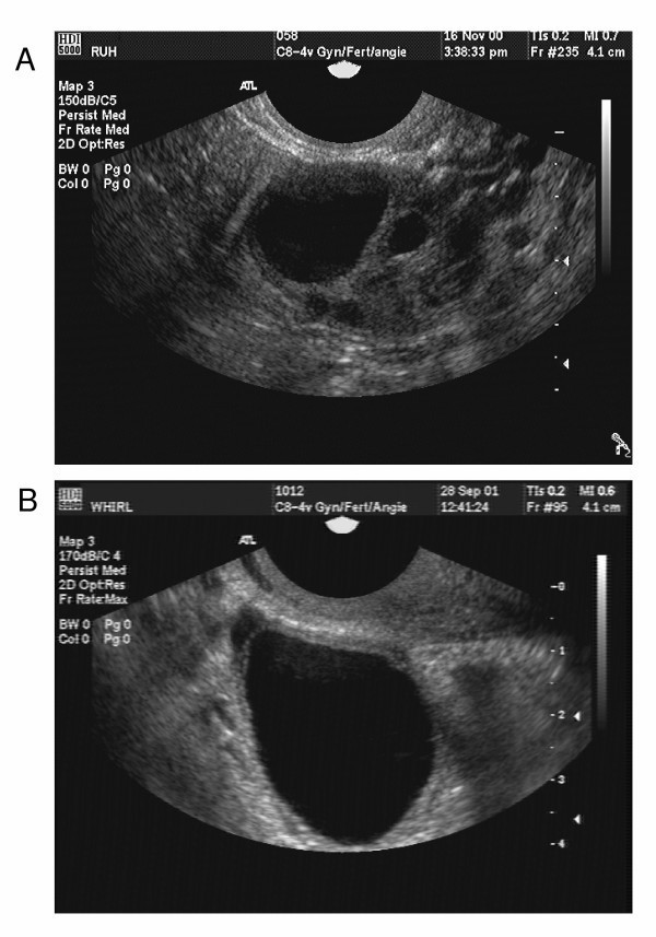A–C) Sonograms of the dominant follicle (Ø 22, 32 and 38 mm) in a