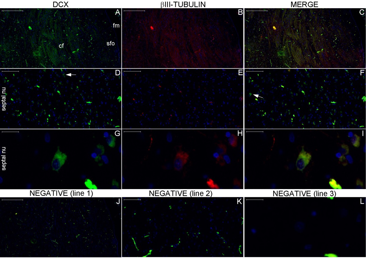 Figure 21