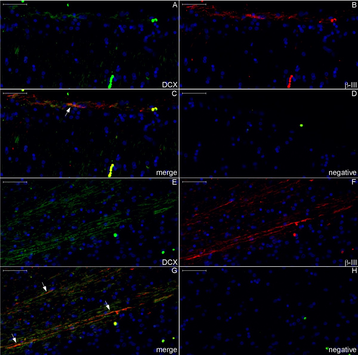 Figure 22