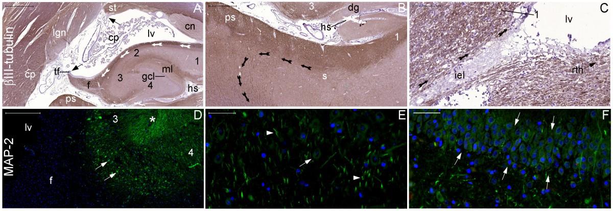 Figure 31