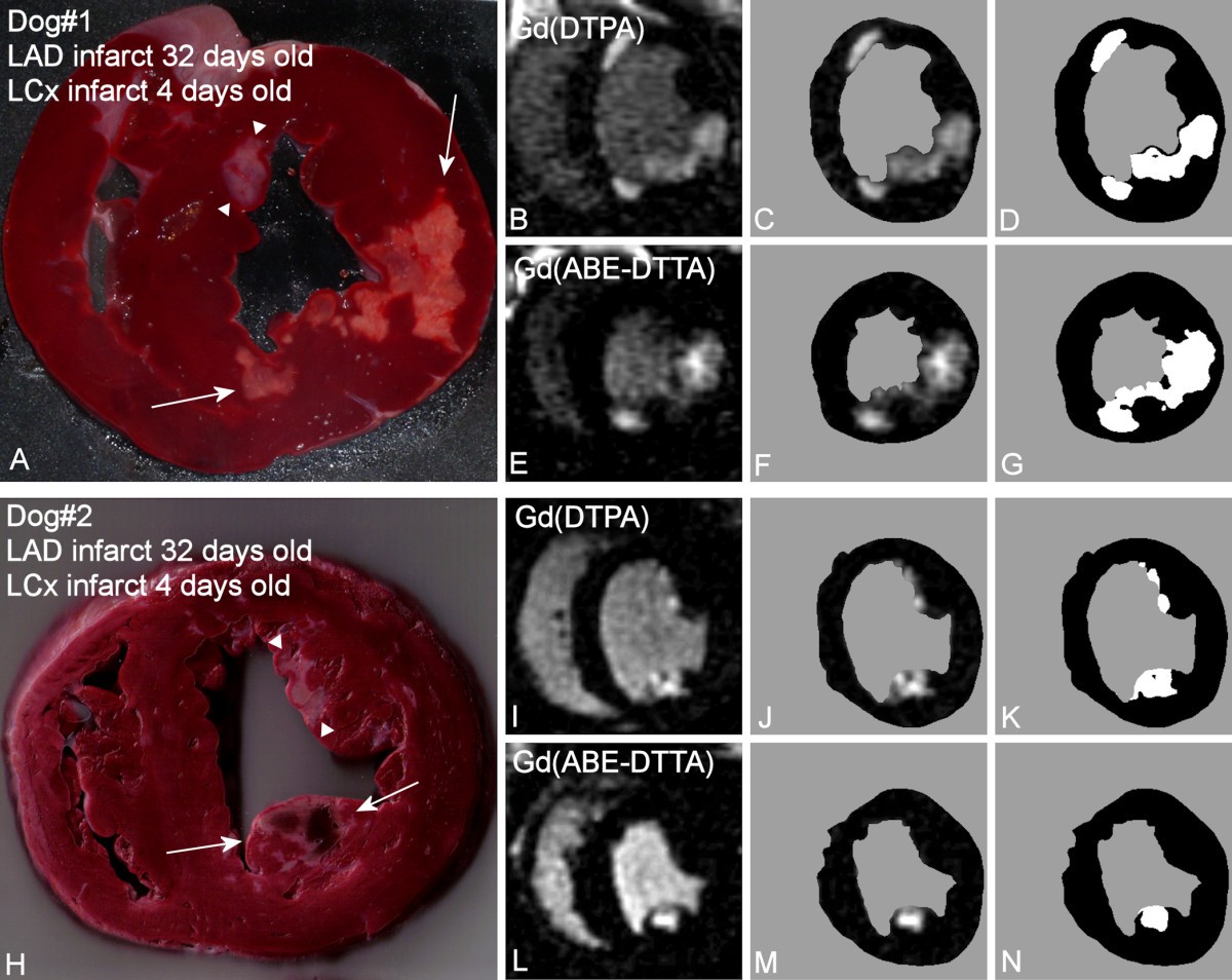 Differentiation of acute and four-week old myocardial infarct with  Gd(ABE-DTTA)-enhanced CMR | Journal of Cardiovascular Magnetic Resonance |  Full Text