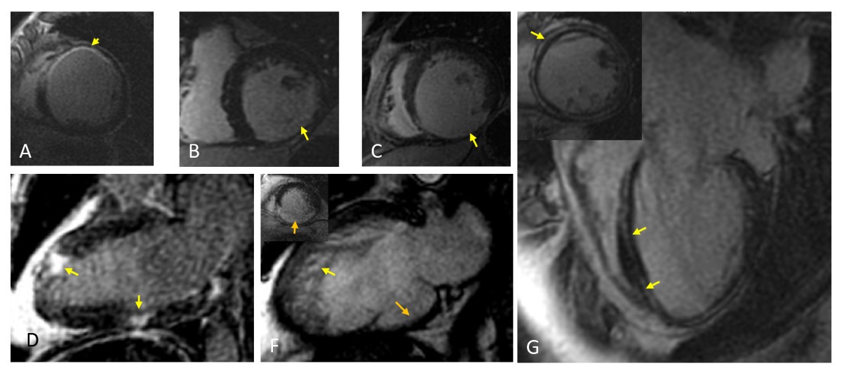 Figure 17