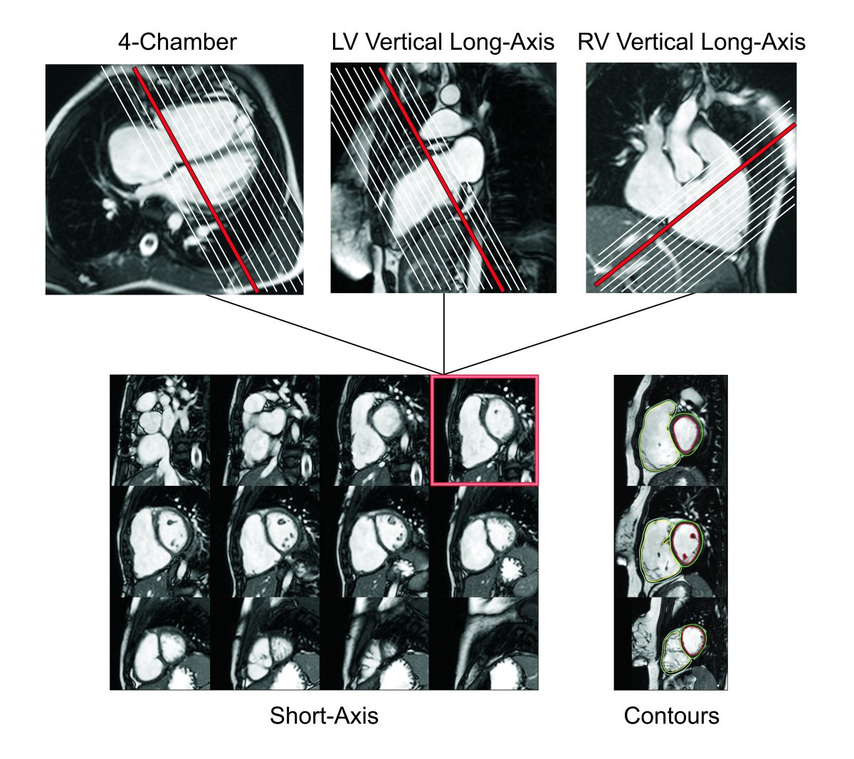 Figure 19