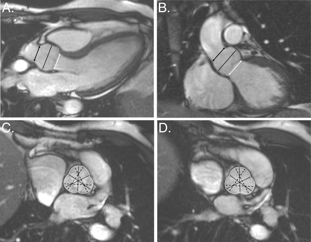 Figure 14