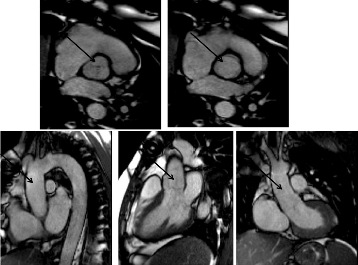 Figure 22