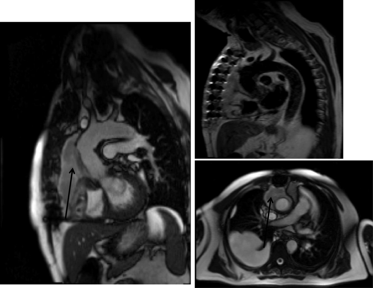 Figure 25