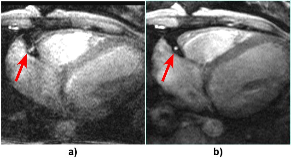 Figure 18