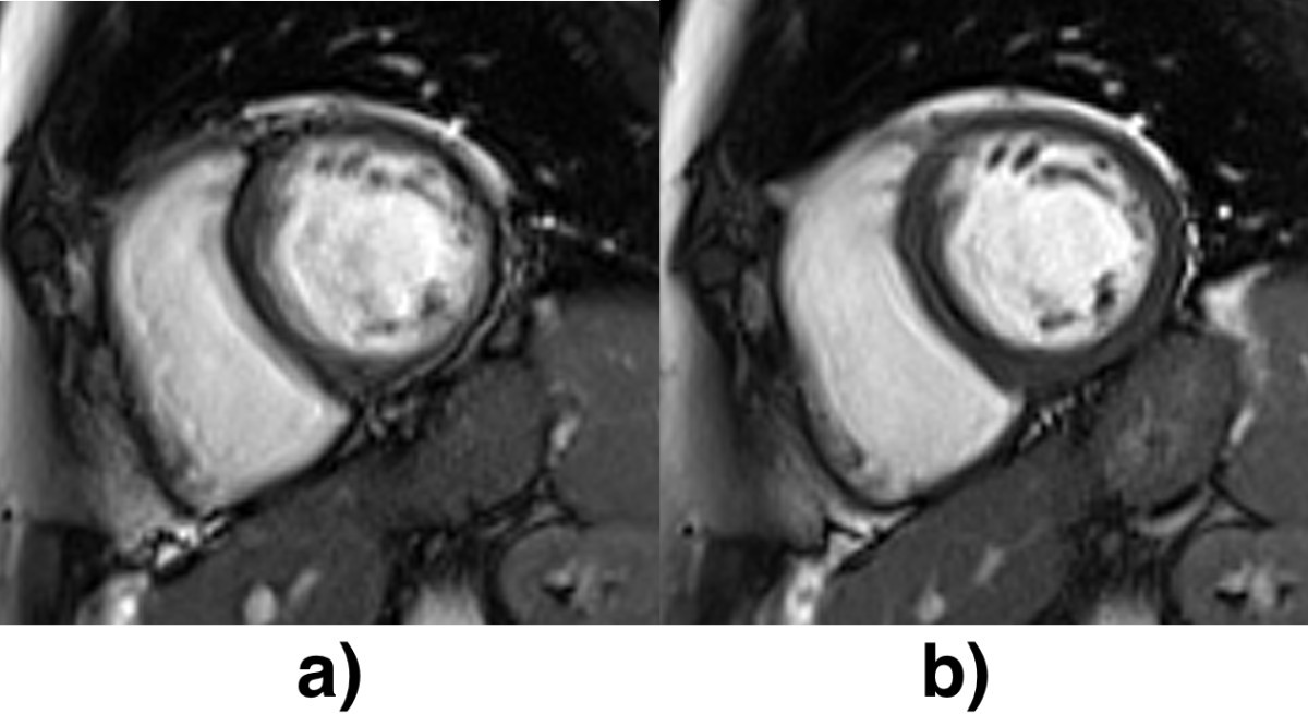 Figure 24