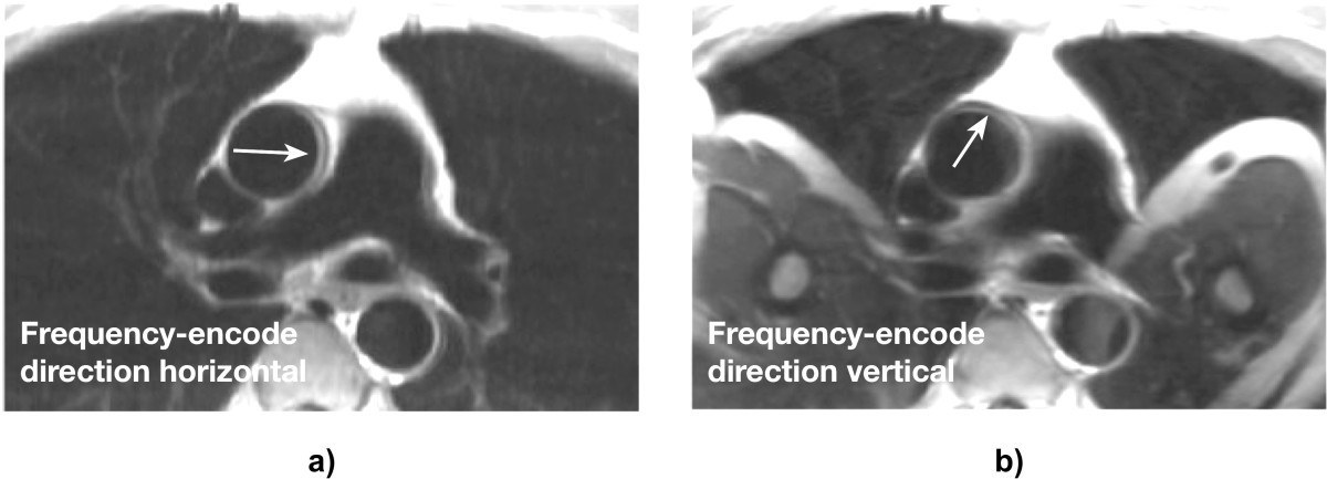 Figure 30