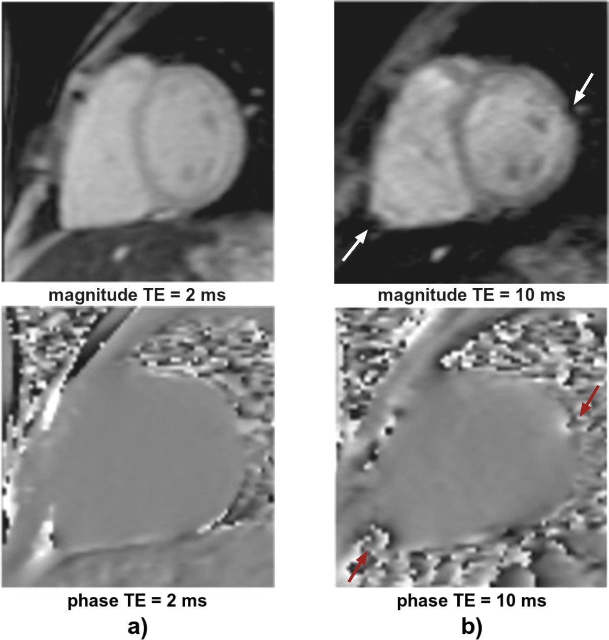 Figure 33