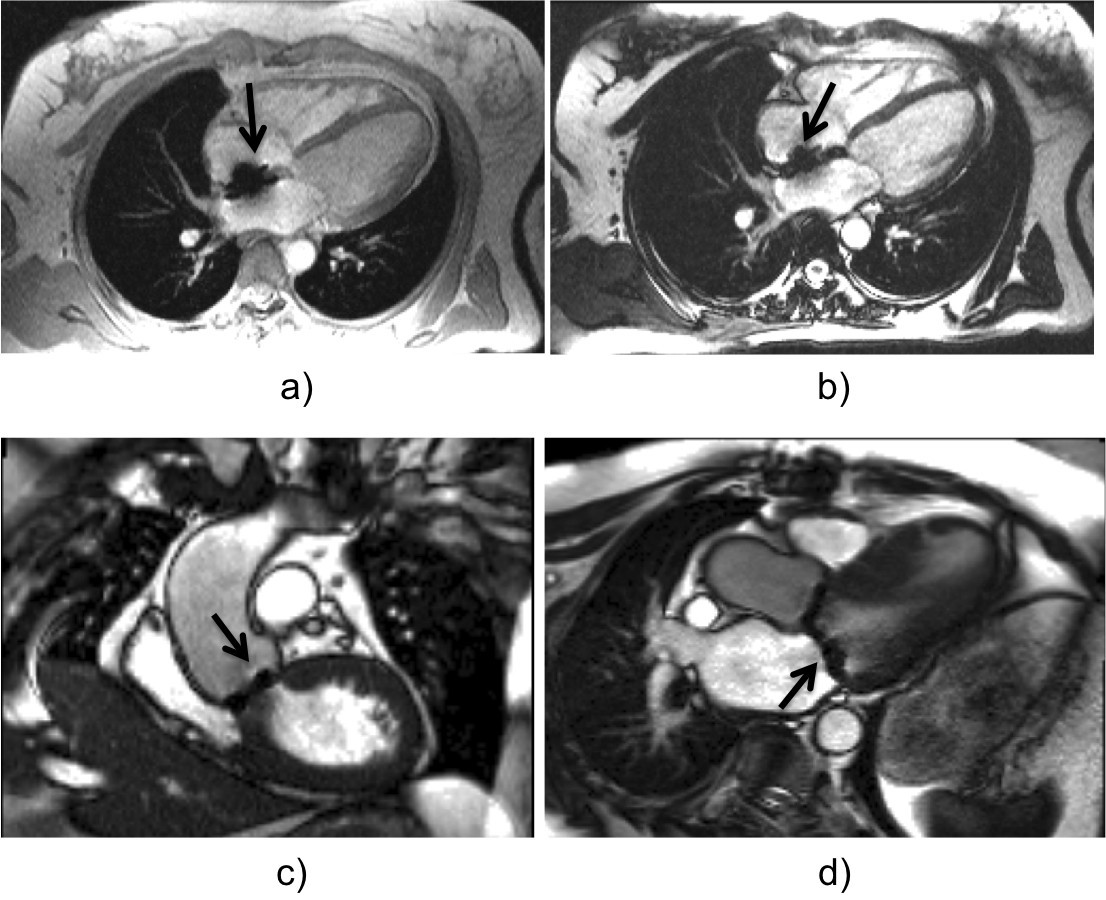 Figure 35