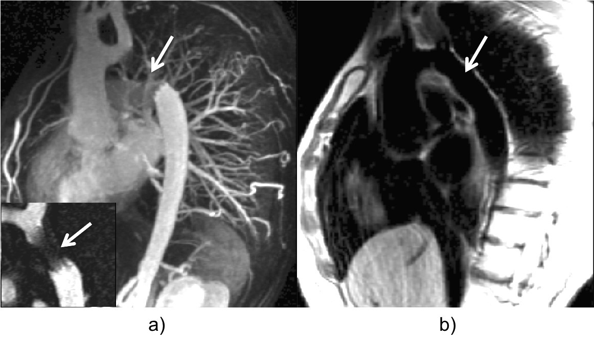 Figure 36