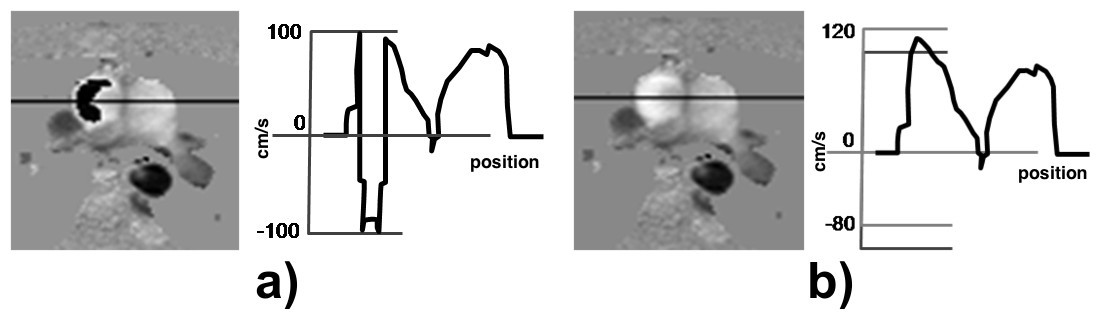 Figure 43