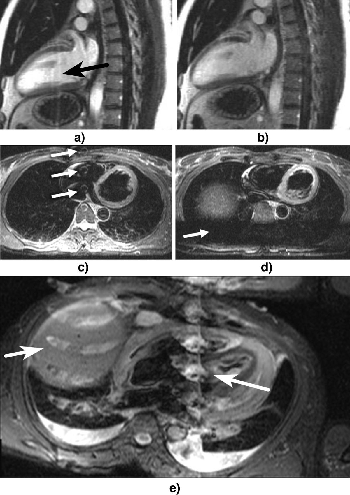 Figure 47