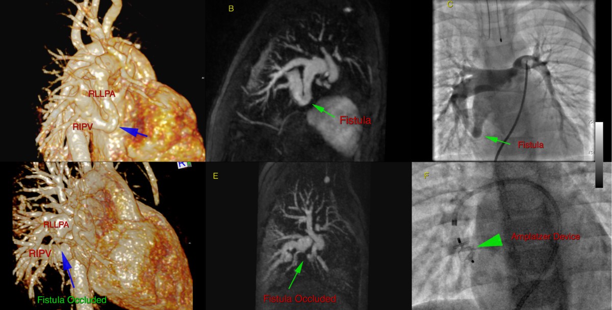 Figure 14