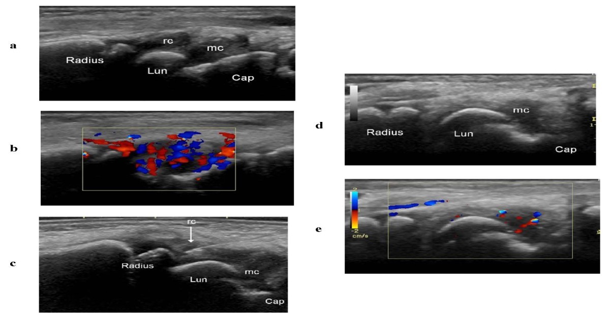 Figure 4