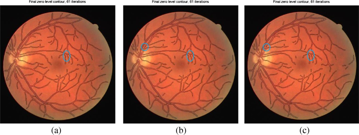 Figure 13