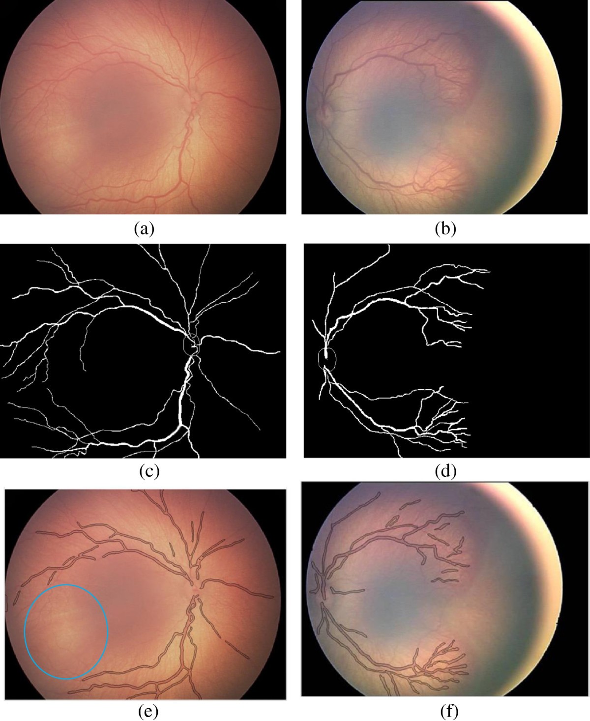 Figure 19