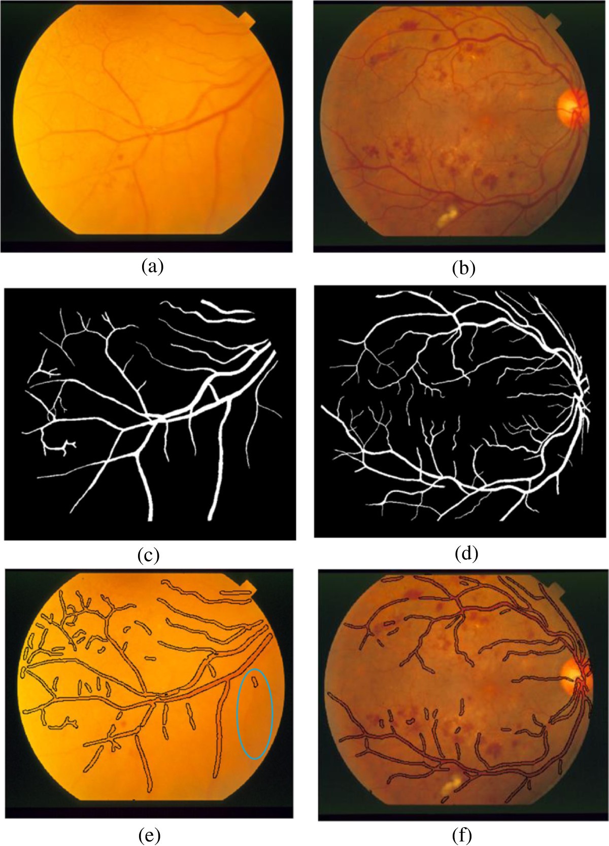 Figure 20