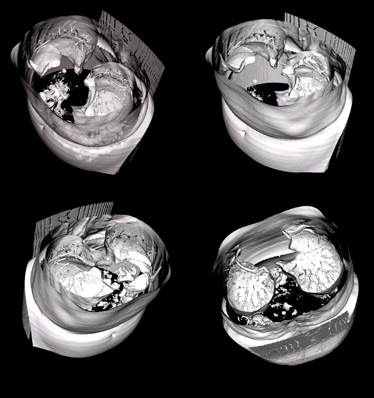 Figure 15