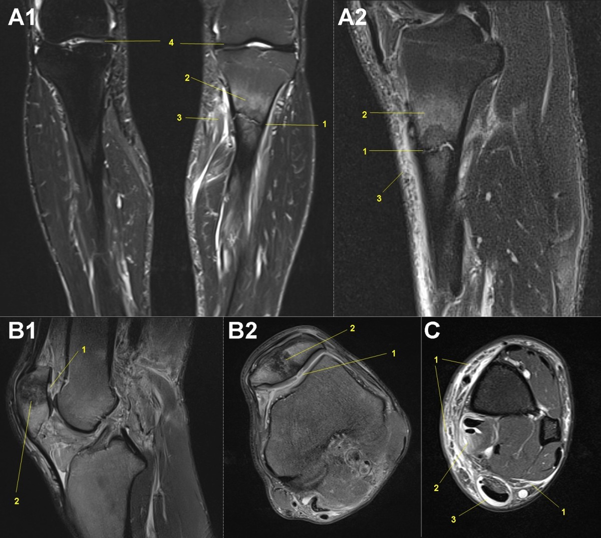 Figure 13