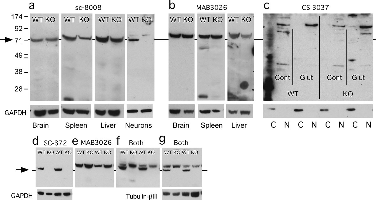 Cautionary notes on the use of NF-κB p65 and p50 antibodies for CNS studies, Journal of Neuroinflammation