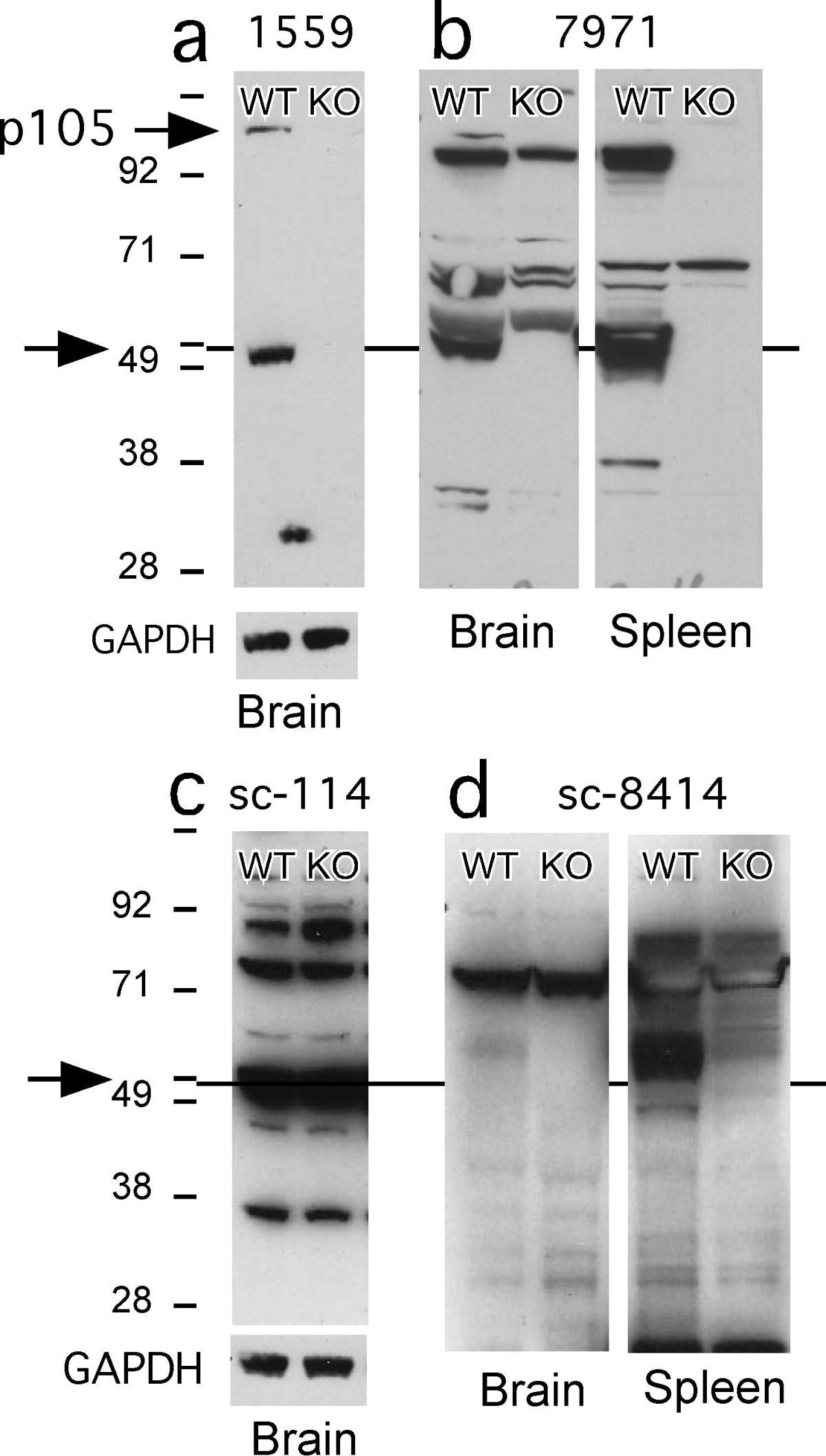 Cautionary notes on the use of NF-κB p65 and p50 antibodies for CNS studies, Journal of Neuroinflammation