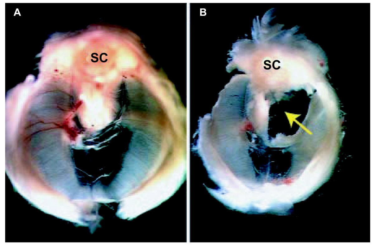 Figure 17