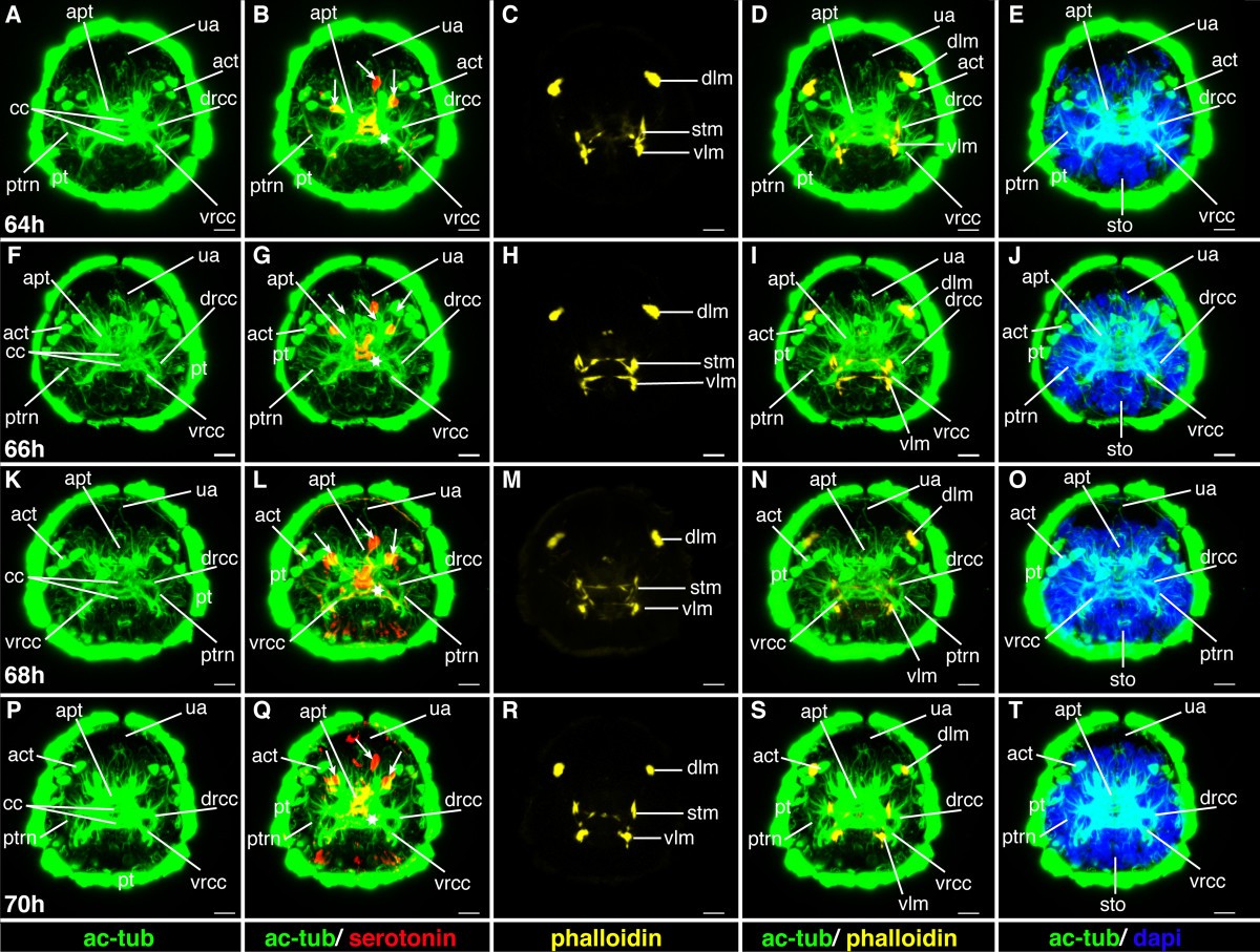 Figure 22